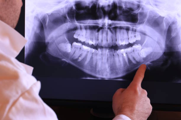 Best Cracked Tooth Emergency Dentist  in Marlinton, WV